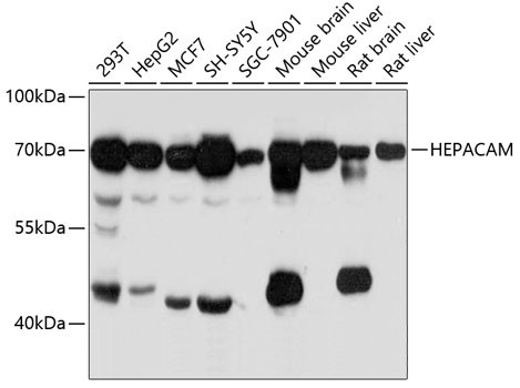 HEPACAM Antibody in Western Blot (WB)