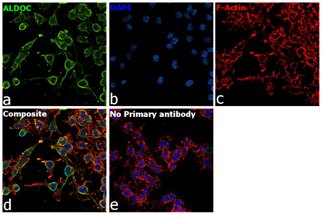 Aldolase C Antibody in Immunocytochemistry (ICC/IF)