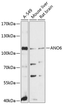 ANO6 Antibody in Western Blot (WB)