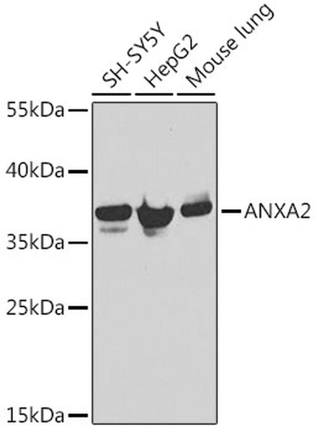 Annexin A2 Antibody in Western Blot (WB)