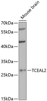 TCEAL2 Antibody in Western Blot (WB)