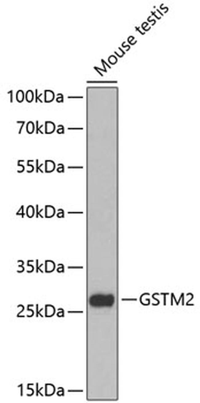 GSTM2 Antibody in Western Blot (WB)