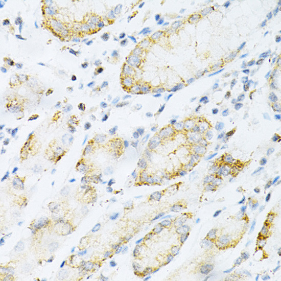 SULT2A1 Antibody in Immunohistochemistry (Paraffin) (IHC (P))