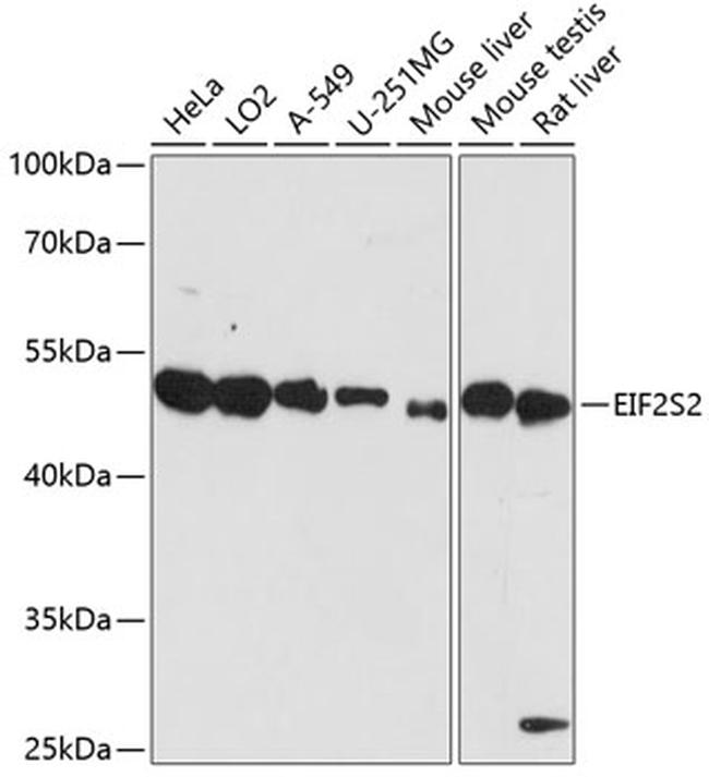 eIF2 beta Antibody in Western Blot (WB)