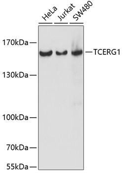 CA150 Antibody in Western Blot (WB)