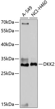 DKK2 Antibody in Western Blot (WB)