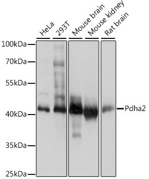 PDHA2 Antibody in Western Blot (WB)