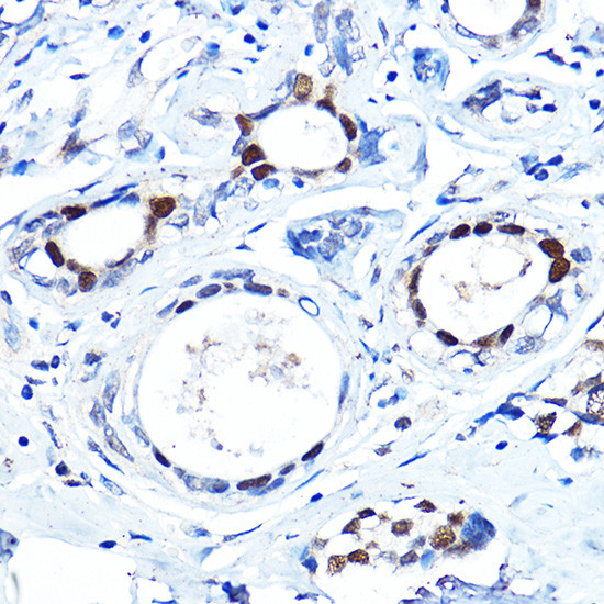 FOXA1 Antibody in Immunohistochemistry (Paraffin) (IHC (P))