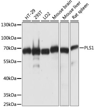 PLS1 Antibody in Western Blot (WB)