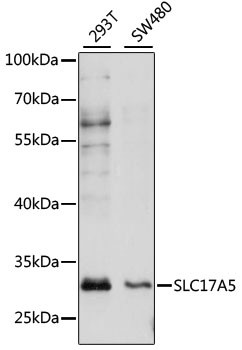 SLC17A5 Antibody in Western Blot (WB)