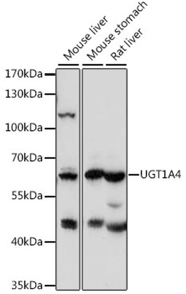 UGT1A4 Antibody in Western Blot (WB)