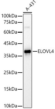 ELOVL4 Antibody in Western Blot (WB)