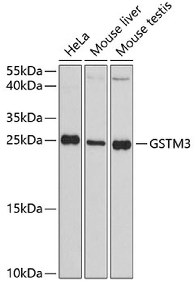 GSTM3 Antibody in Western Blot (WB)
