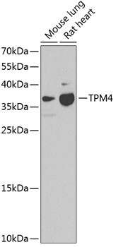 TPM4 Antibody in Western Blot (WB)