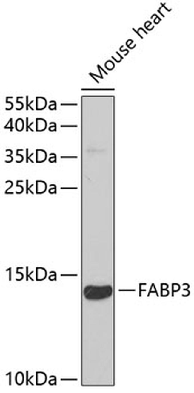FABP3 Antibody in Western Blot (WB)