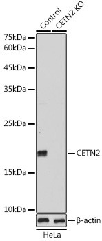 Centrin 2 Antibody in Western Blot (WB)