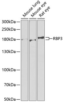 RBP3 Antibody in Western Blot (WB)