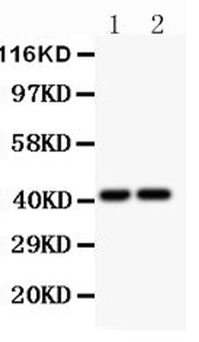 CXCR3 Antibody in Western Blot (WB)