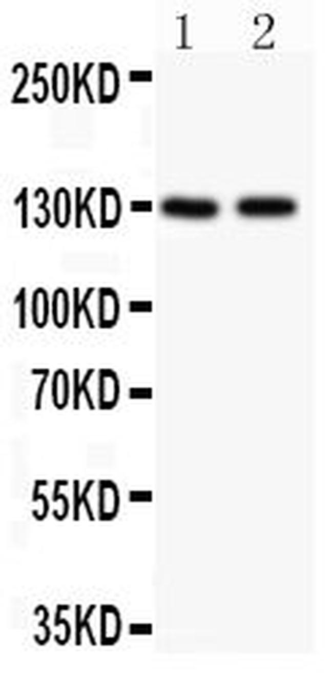 TSC1 Antibody in Western Blot (WB)