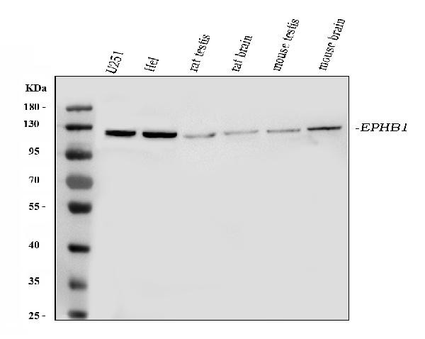 EphB1 Antibody in Western Blot (WB)