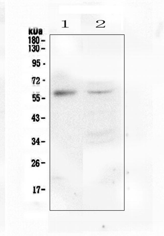M-CSF Antibody in Western Blot (WB)