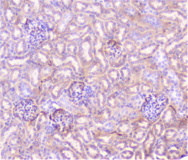TNFR1 Antibody in Immunohistochemistry (Paraffin) (IHC (P))