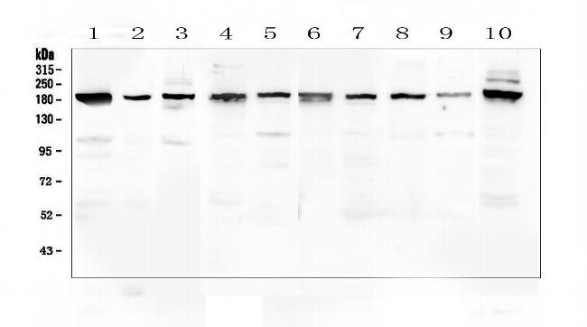 PCDH15 Antibody in Western Blot (WB)