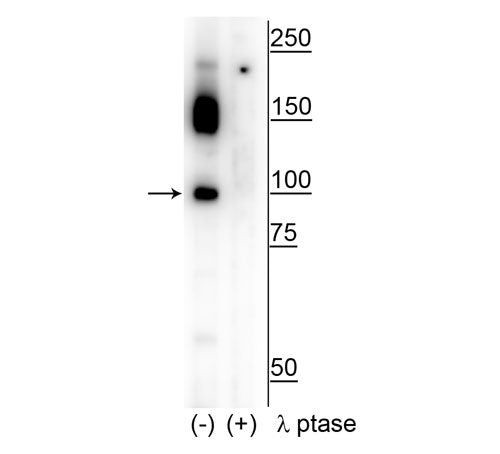 Phospho-CtIP (Ser326) Antibody in Western Blot (WB)