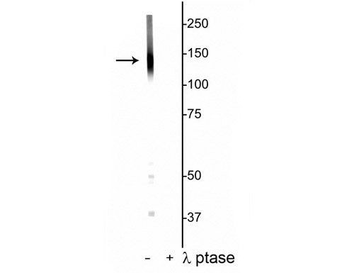 Phospho-KCC2 (Thr1007) Antibody in Western Blot (WB)