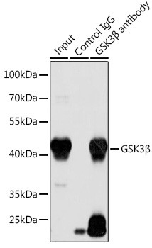 GSK3B Antibody in Immunoprecipitation (IP)