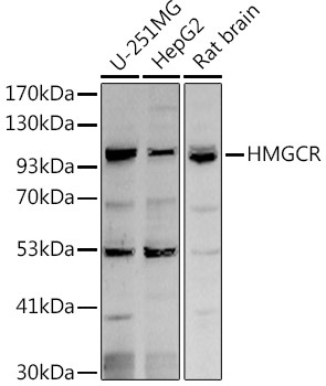 HMGCR Antibody in Western Blot (WB)