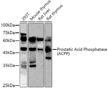 Prostate Specific Acid Phosphatase Antibody in Western Blot (WB)