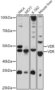 VDR Antibody in Western Blot (WB)