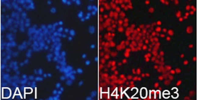 H4K20me3 Antibody in Immunocytochemistry (ICC/IF)