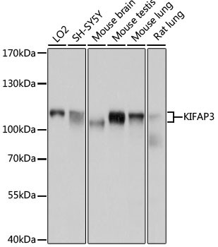 KAP3 Antibody in Western Blot (WB)
