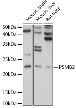PSMB2 Antibody in Western Blot (WB)