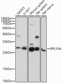 RPL10A Antibody in Western Blot (WB)