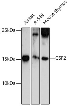 GM-CSF Antibody in Western Blot (WB)