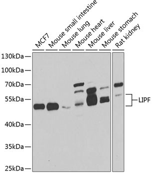 LIPF Antibody in Western Blot (WB)