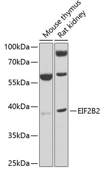 eIF2b beta Antibody in Western Blot (WB)