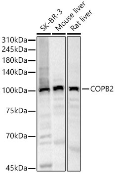 COPB2 Antibody in Western Blot (WB)