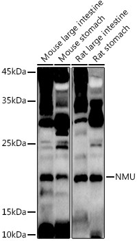 Neuromedin U Antibody in Western Blot (WB)