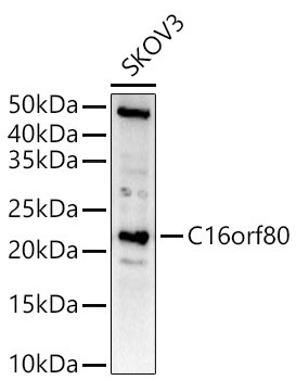GTL3 Antibody in Western Blot (WB)