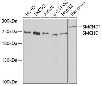 SMCHD1 Antibody in Western Blot (WB)