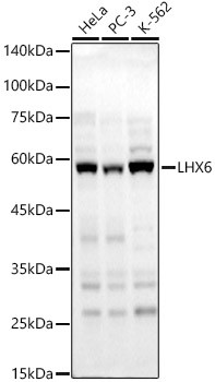 LHX6 Antibody in Western Blot (WB)