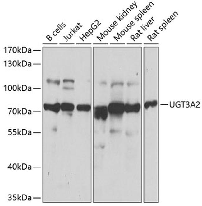 UGT3A2 Antibody in Western Blot (WB)