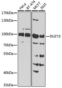 SUZ12 Antibody in Western Blot (WB)