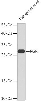 RGR Antibody in Western Blot (WB)