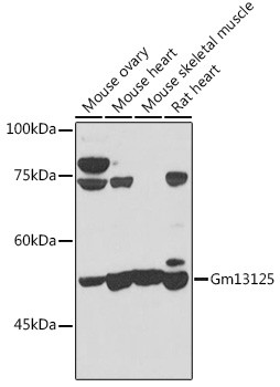 PRAMEF20 Antibody in Western Blot (WB)