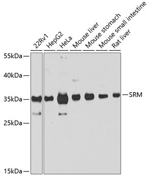 SRM Antibody in Western Blot (WB)